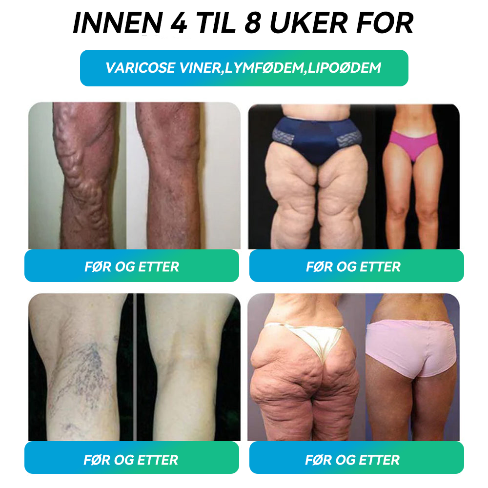 Offisiell butikk | 𝑯𝑯𝑽𝑩®👩⚕️🥇GLP-1 vekttap oral løsning Bare én gang i uken, synlige resultater på 7 dager ✅ For fedme, hjerte- og karsykdommer, diabetes, søvnapné, leddproblemer og mer