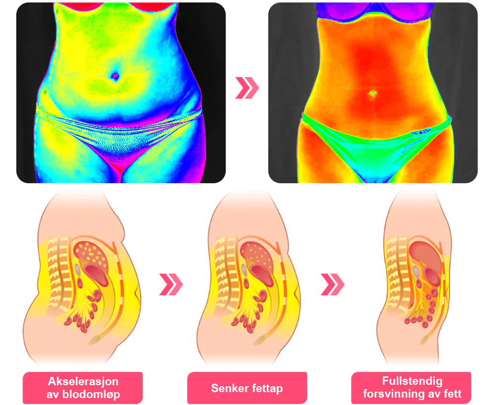 𝑷𝑬𝑨𝑹𝑳𝑴𝑶𝑶𝐍™ Isesilke Ionfiber Reparerende og Formende Shorts 👨⚕️Fettforbrenning, oppstramming av huden, fremmer blodsirkulasjon og lymfedrenasje for helhetlig helse