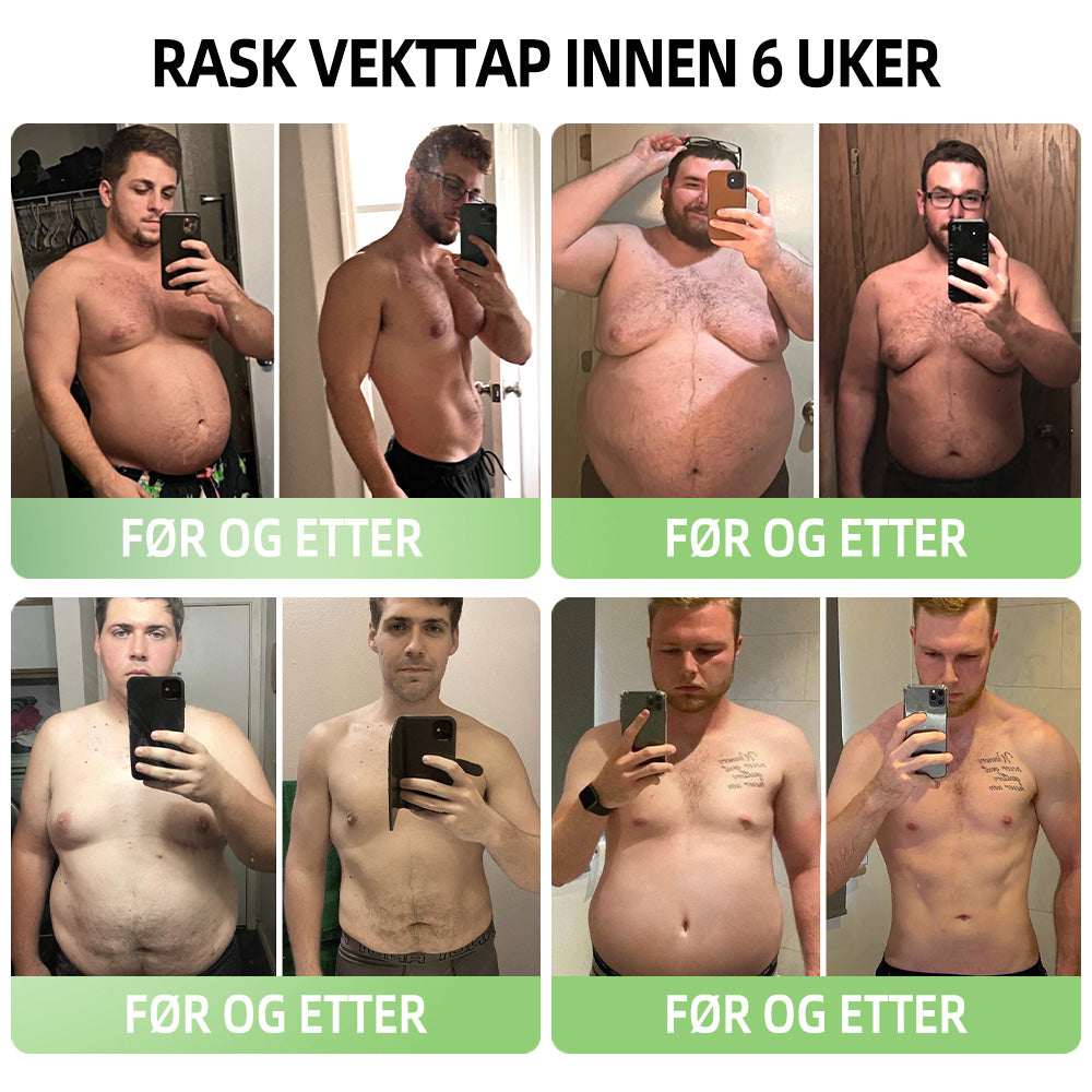 𝑷𝑬𝑨𝑹𝑳𝑴𝑶𝑶𝐍™ Isesilke Ionfiber Reparerende og Formende Shorts 👨⚕️Fettforbrenning, oppstramming av huden, fremmer blodsirkulasjon og lymfedrenasje for helhetlig helse