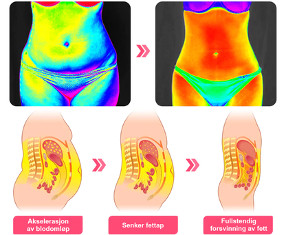 𝑷𝑬𝑨𝑹𝑳𝑴𝑶𝑶𝐍™ Isesilke Ionfiber Reparerende og Formende Shorts 👨‍⚕️Fettforbrenning, oppstramming av huden, fremmer blodsirkulasjon og lymfedrenasje for helhetlig helse