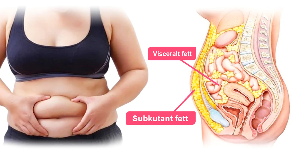 𝑷𝑬𝑨𝑹𝑳𝑴𝑶𝑶𝐍™ Isesilke Ionfiber Reparerende og Formende Shorts 👨‍⚕️Fettforbrenning, oppstramming av huden, fremmer blodsirkulasjon og lymfedrenasje for helhetlig helse