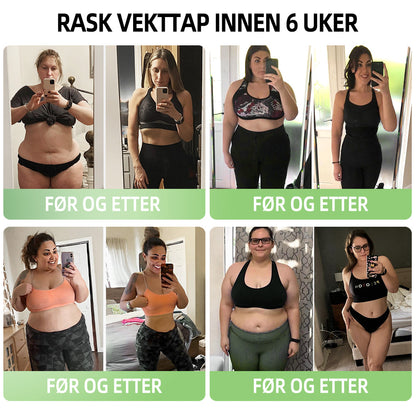 𝑷𝑬𝑨𝑹𝑳𝑴𝑶𝑶𝐍™ Isesilke Ionfiber Reparerende og Formende Shorts 👨‍⚕️Fettforbrenning, oppstramming av huden, fremmer blodsirkulasjon og lymfedrenasje for helhetlig helse