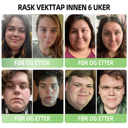 𝑷𝑬𝑨𝑹𝑳𝑴𝑶𝑶𝐍™ Isesilke Ionfiber Reparerende og Formende Shorts 👨‍⚕️Fettforbrenning, oppstramming av huden, fremmer blodsirkulasjon og lymfedrenasje for helhetlig helse